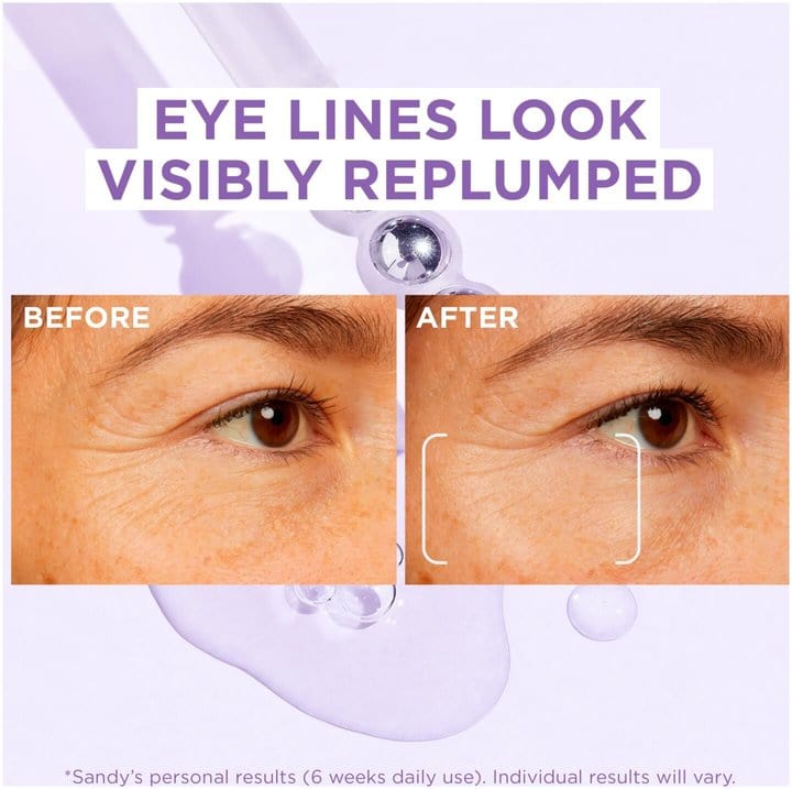 L'Oréal Paris Revitalift Filler Eye Treatment with Hyaluronic Acid, 20 ml
